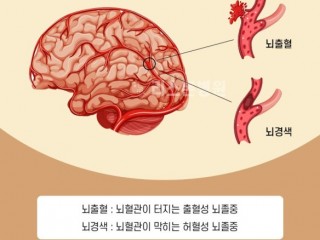 피가 너무 많이 난다, 출혈