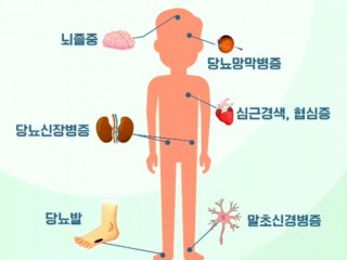 당뇨 예방 "공진신기환"