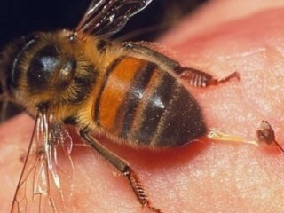 벌에 쏘였을 때