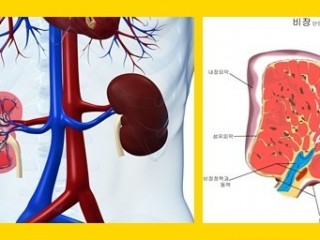 신장이 나쁘면 붓는다?