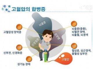 고혈압에 관한 상식의 허와 실(2)