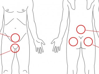 엉치가 아픈 골반통