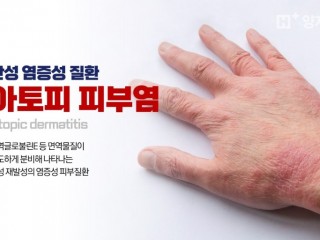 아토피 피부염 - "아이 몸에 이상한 돌기가 생겼어요"