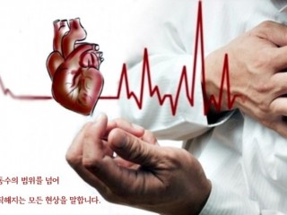 부정맥이란 무엇인가?