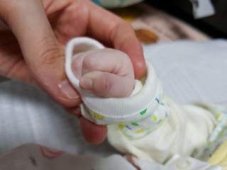 손발 피멍 들었을때