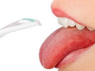 누렇게 변한 혀