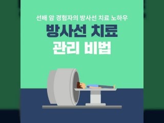 방사선치료.....후두암 등 조기발견땐 90% 완치