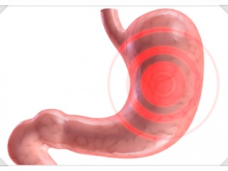 급체시 이렇게 하세요
