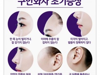 안면경련증, 피로·스트레스로 악화