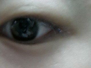 눈이 심하게 아플 때