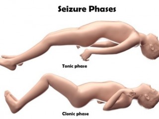 경련을 일으켰을 때