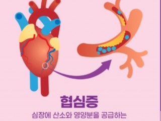 협심증에 좋은 "녹용귀비탕"