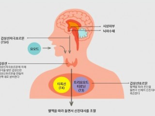 갑상선호르몬 - 과다분비땐 땀 많이 흘리고 숨차